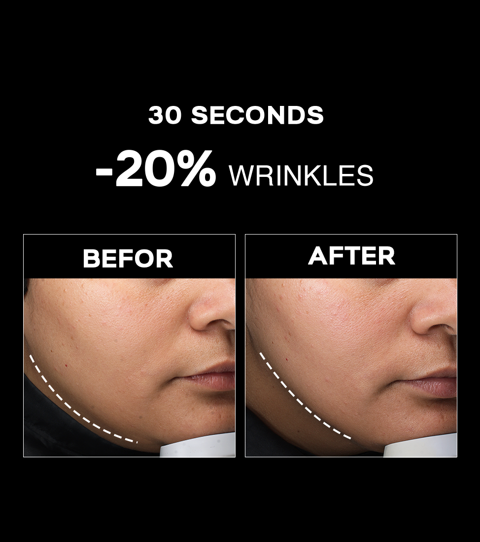 Ultimate Mori-Lift Mist