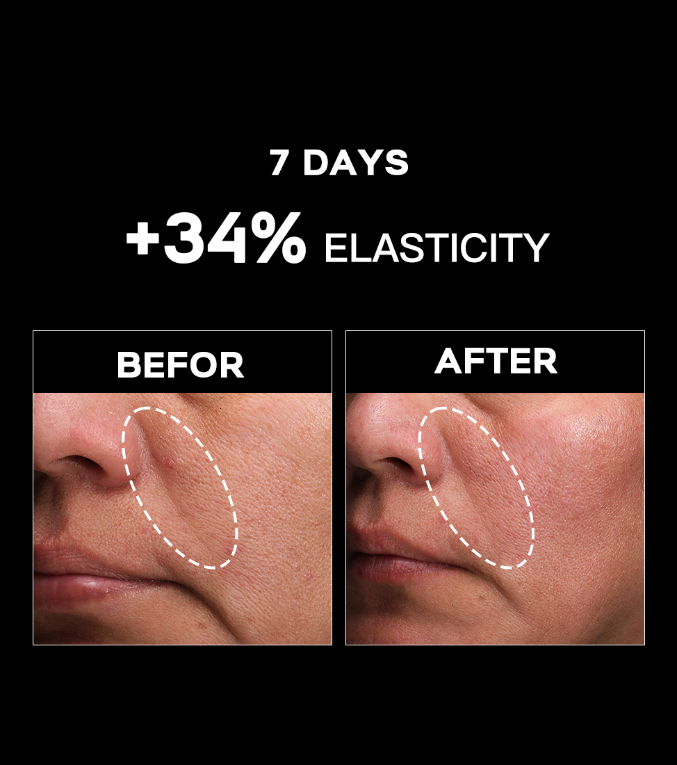 Ultimate Mori-Lift Mist