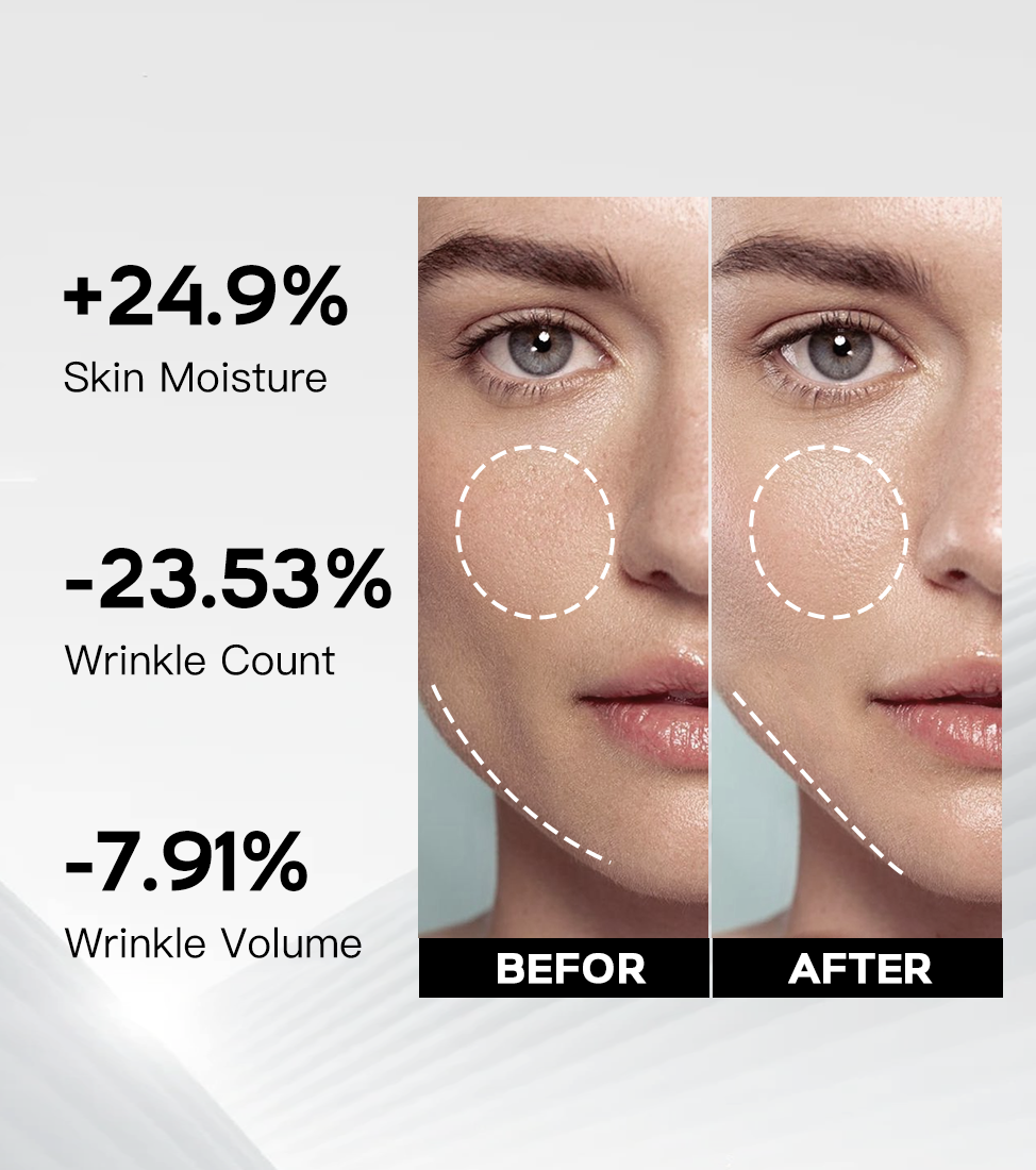 Ultimate Mori-Lift Collagen Mask (3 Pcs/Pack) | Mori-Bandage