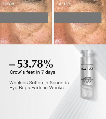 moritek ultimate mori-lift depuff eye serum