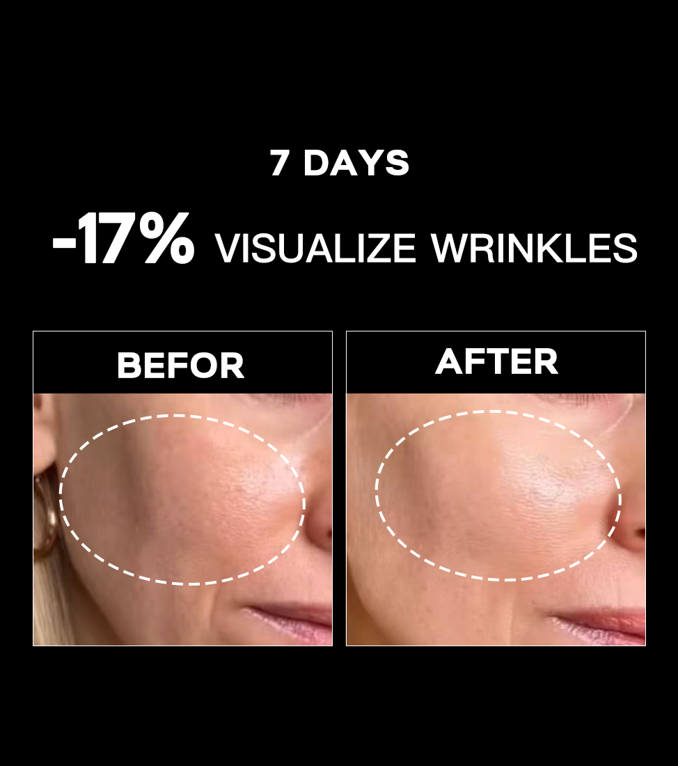 5Pcs setLimited One Time Deal: 20% Off Your First Purchase!” 5PCS Ultimate Mori-Lift Mist